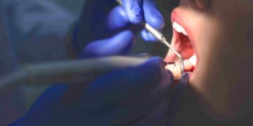 Veja como receber tratamento dentário GRATUITO pelo SUS; documentos, benefícios e MAIS