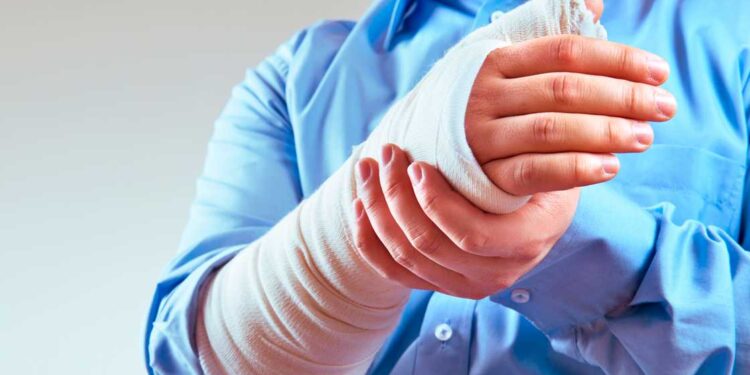 Auxílio-Acidente: Entenda o que é e como funciona!