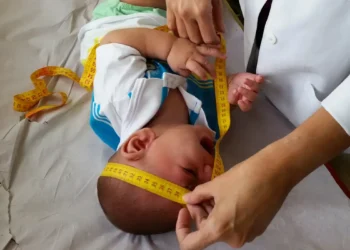 Governo irá indenizar famílias com bebês deficientes devido ao zika vírus