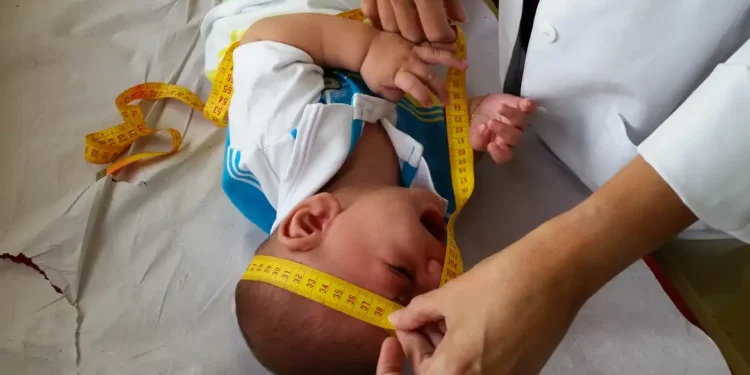 Governo irá indenizar famílias com bebês deficientes devido ao zika vírus