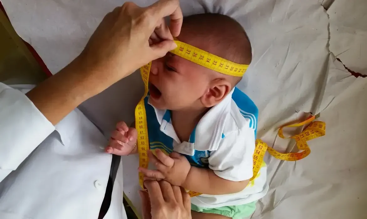 Médico medindo a cabeça de bebê com possível microcefalia causada pelo vírus Zika