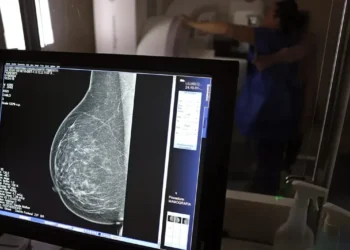 Exame de mamografia: diagnóstico essencial para a saúde da mulher.