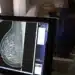 Exame de mamografia: diagnóstico essencial para a saúde da mulher.