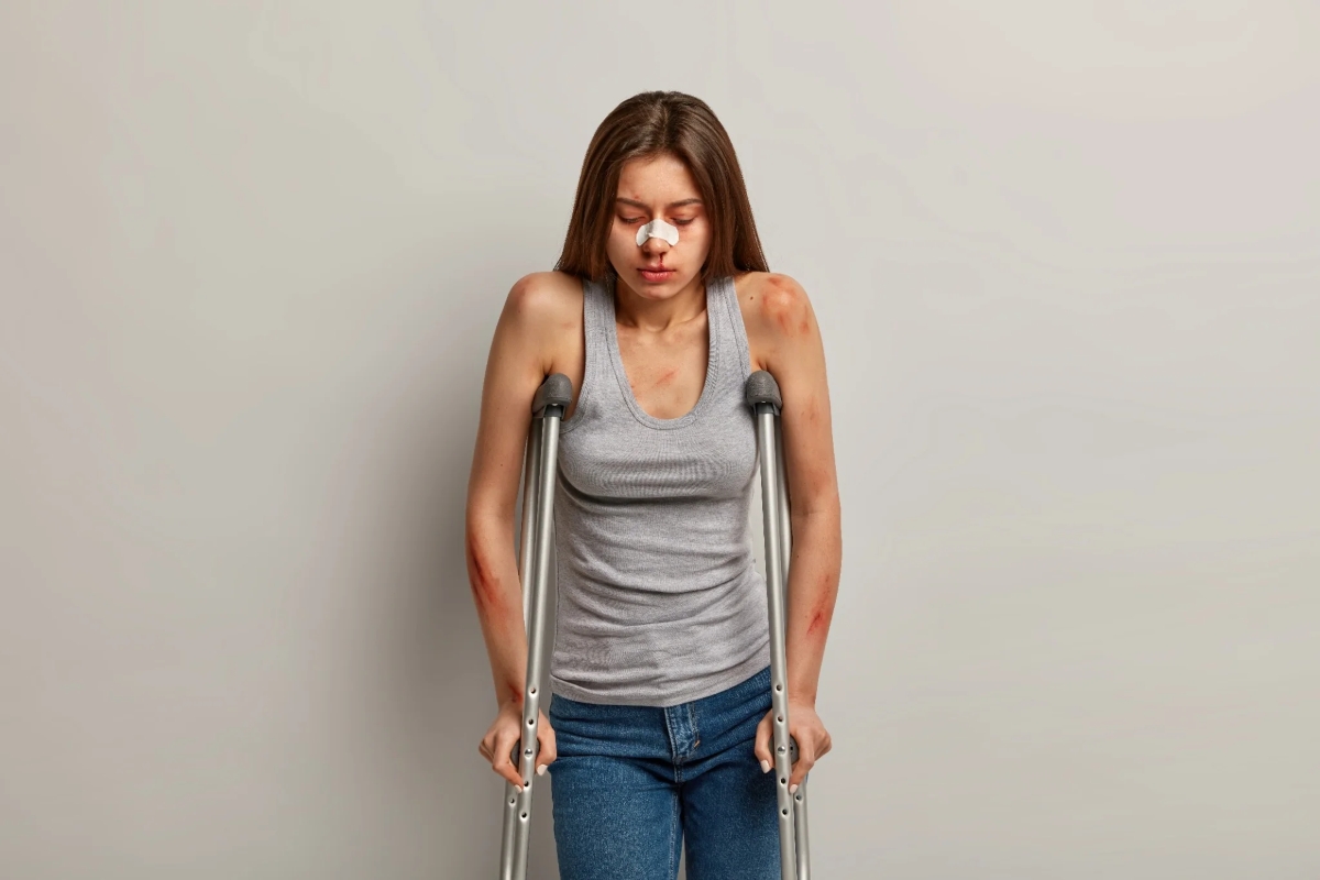 Mulher com lesões visíveis no corpo e rosto, apoiando-se em muletas após acidente, em recuperação com o auxílio-doença, conforme a decisão do STF em 2025.
